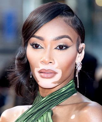 Winnie Harlow photo